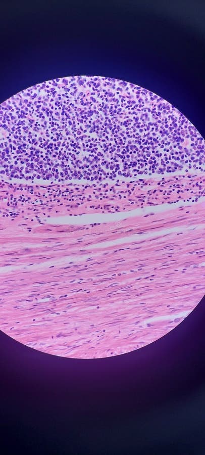 Appendix histology microscope learn more about tissues royalty free stock photography