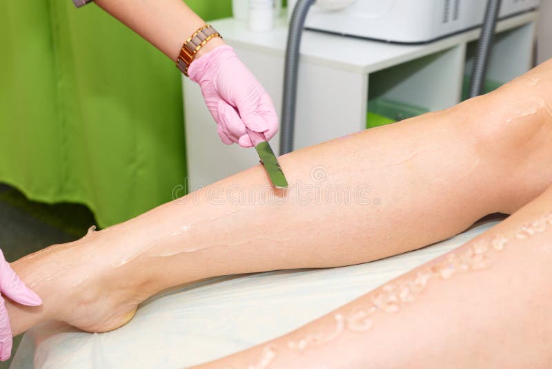Application of Contact Gel before Laser Hair Removal Procedure. Preparation of the Skin Surface for Laser Hair Removal. Stock Photo - Image of beautician, healthy: 137566144 Application of Contact Gel before Laser Hair Removal Procedure. Preparation of the Skin Surface for Laser Hair Removal. Stock Photo - Image of beautician, healthy: 137566144