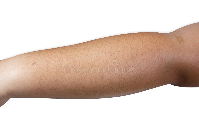 261 Checking Spots Stock Photos Free & RoyaltyFree Stock Photos from