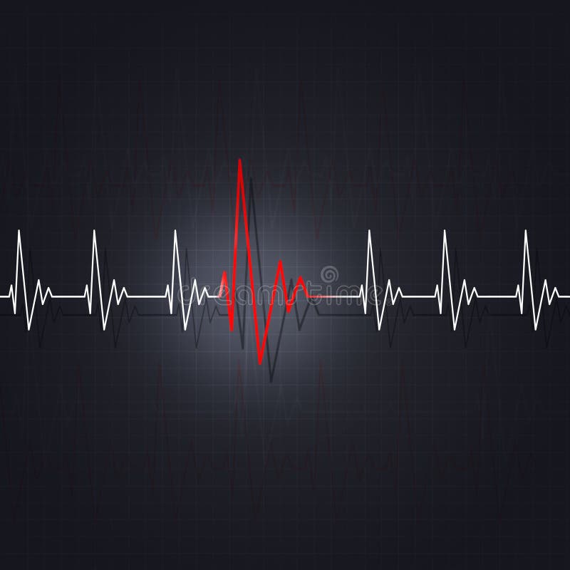 Arrhythmia of a Heart