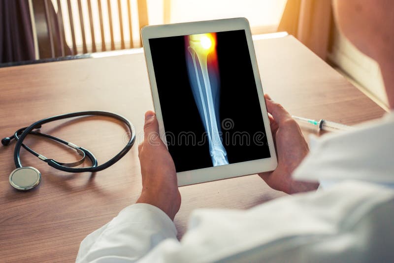 Arts die een digitale tablet met r?ntgenstraal van been met pijn op de interne knie houden Stethoscoop en spuit op het bureau royalty-vrije stock afbeeldingen Arts die een digitale tablet met r?ntgenstraal van been met pijn op de interne knie houden Stethoscoop en spuit op het bureau royalty-vrije stock afbeeldingen