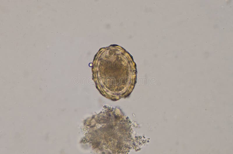 Ascaris Lumbricoides Egg in Stool Exam Stock Photo Image of medical