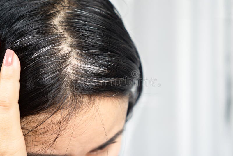 Closeup Asian Woman Having Problem with Grey, White Hair Growing Up Stock  Photo - Image of bald, front: 218207150