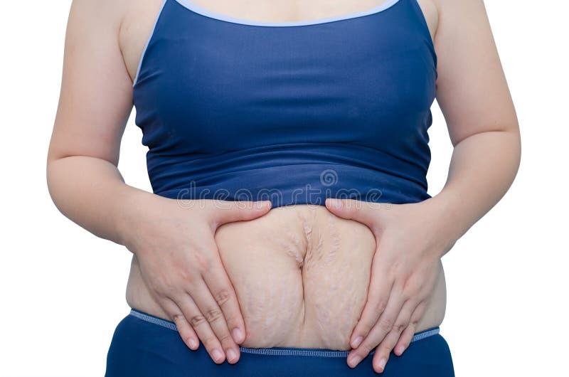 Asian woman in swim suit showing her stretch marks on white background