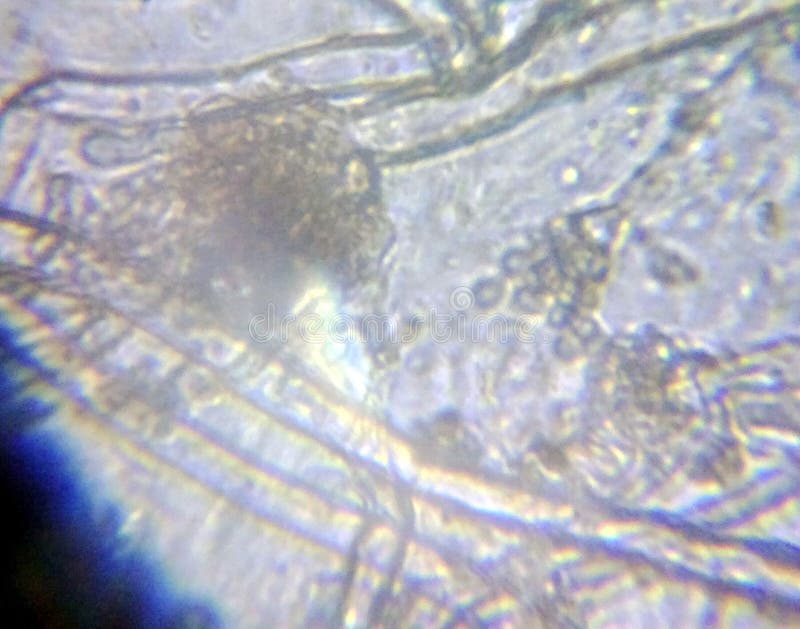 Aspergillus niger the black mold conidia under the microscope royalty free stock photography