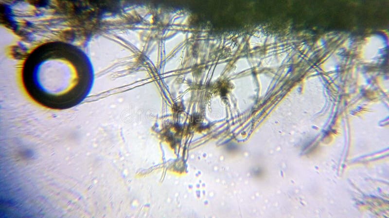 Aspergillus niger the black mold conidia under the microscope stock photography
