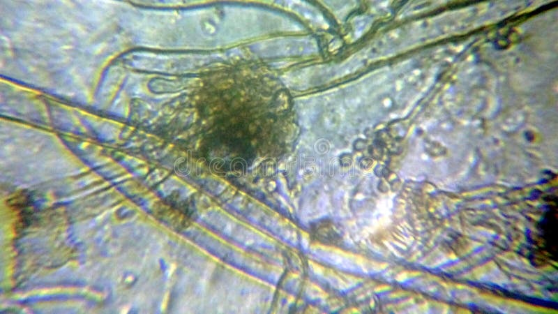 Aspergillus niger the black mold conidia under the microscope stock photography
