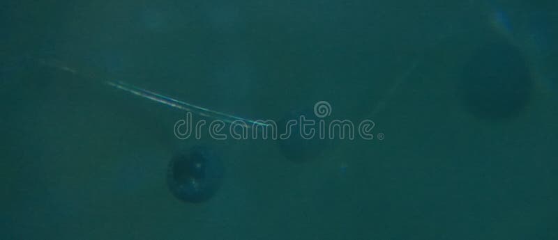 Aspergillus niger the black mold conidia under the microscope royalty free stock photo