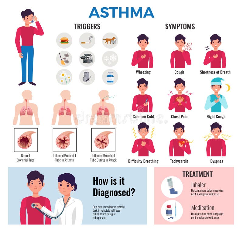 Asthma Infographic Elements Set vector illustration Asthma Infographic Elements Set vector illustration