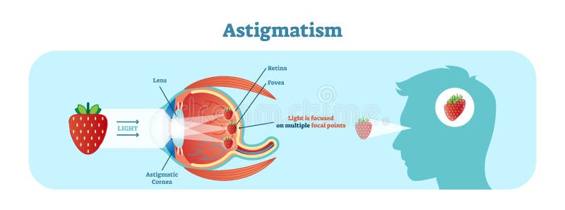 diagramă de test ocular de astigmatism)