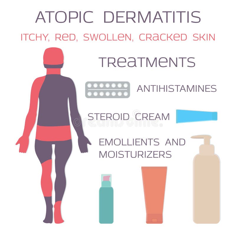 Atopic dermatitis, egzema Lekarstwo jest antyhistamin pastylkami i steryd śmietankami ilustracji Atopic dermatitis, egzema Lekarstwo jest antyhistamin pastylkami i steryd śmietankami ilustracji