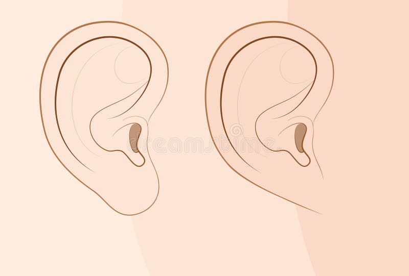 Attached Earlobe Free Earlobe In Comparison