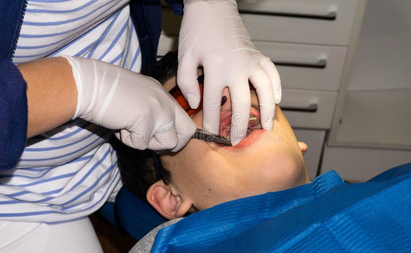 Autistic boy in dental treatment. brace. health care royalty free stock photos Autistic boy in dental treatment. brace. health care royalty free stock photos