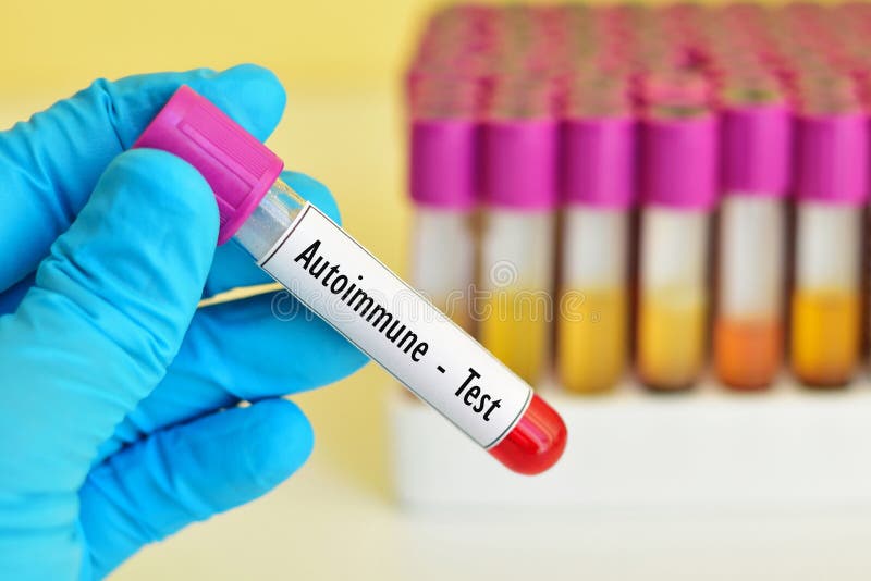 Autoimmune test stock image. Image of disease, scientific 68974727