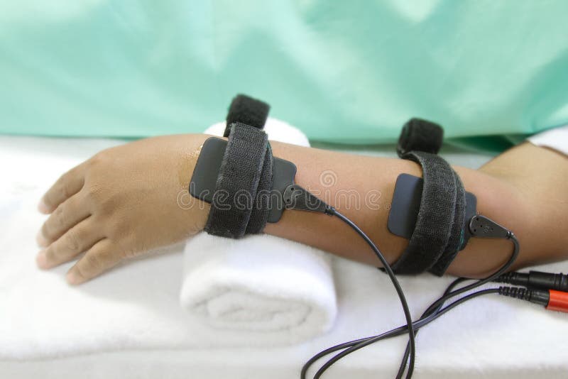 Avant-bras électrique de stimulation images libres de droits Avant-bras électrique de stimulation images libres de droits