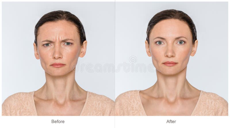 Avant et après le concept d'anti-âge photos stock Avant et après le concept d'anti-âge photos stock