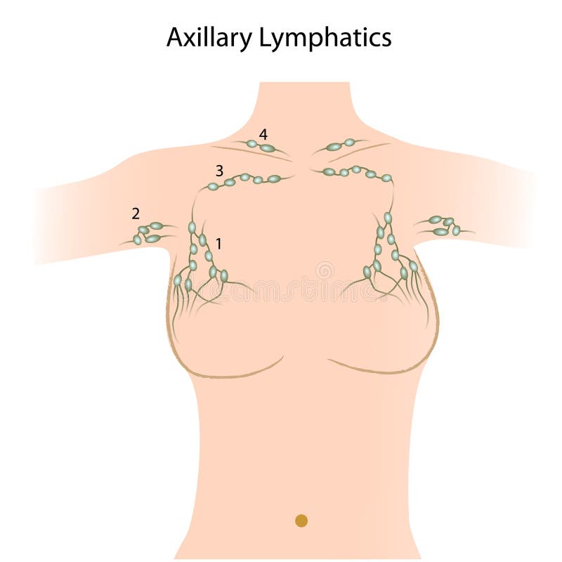 Woman Breast Implant Cross Section. Stock Illustration - Illustration of  female, anatomy: 39457636