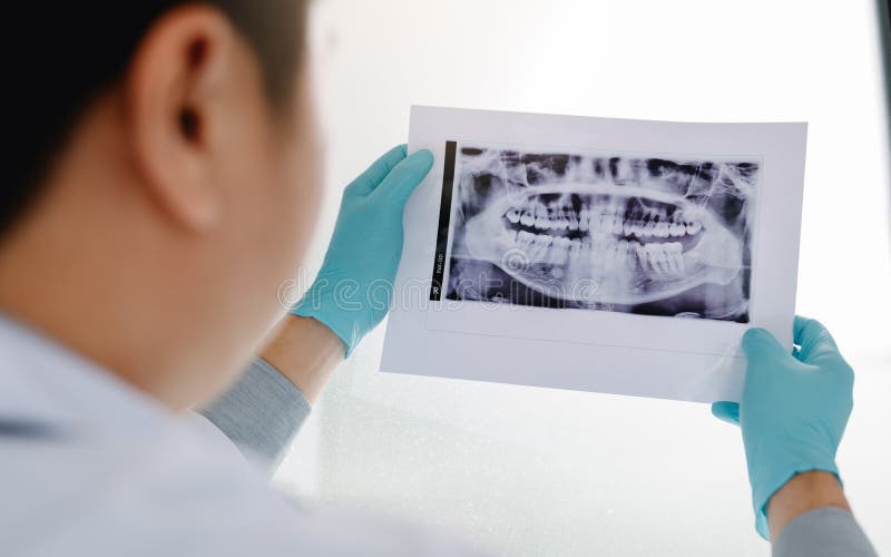 Azjatyccy męscy dentyści analizują promieniowanie rentgenowskie wizerunki pacjenci przy lab zdjęcie stock Azjatyccy męscy dentyści analizują promieniowanie rentgenowskie wizerunki pacjenci przy lab zdjęcie stock