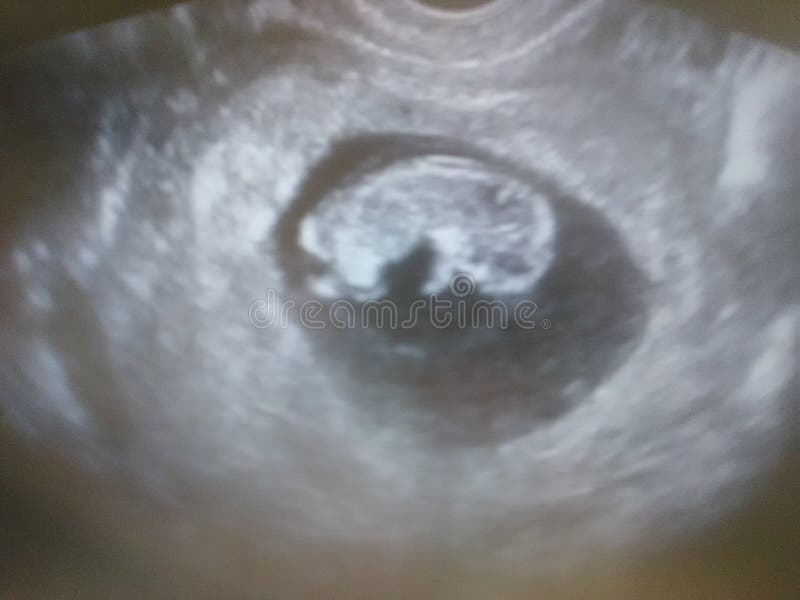 Baby stockbilder Baby stockbilder