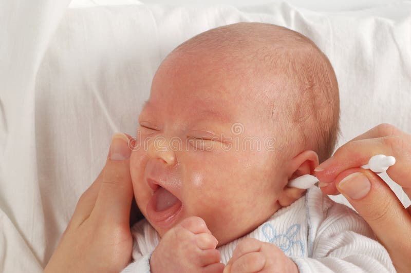 Oral thrush stock image. Image of antifungals, infant 42509443