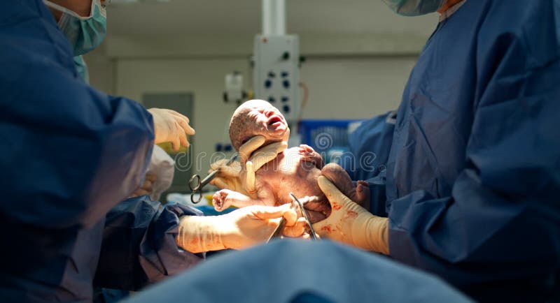 Baby being born via Caesarean Section royalty free stock photo Baby being born via Caesarean Section royalty free stock photo