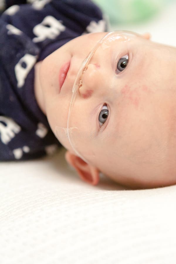 Baby With Breathing Tube royalty free stock images Baby With Breathing Tube royalty free stock images