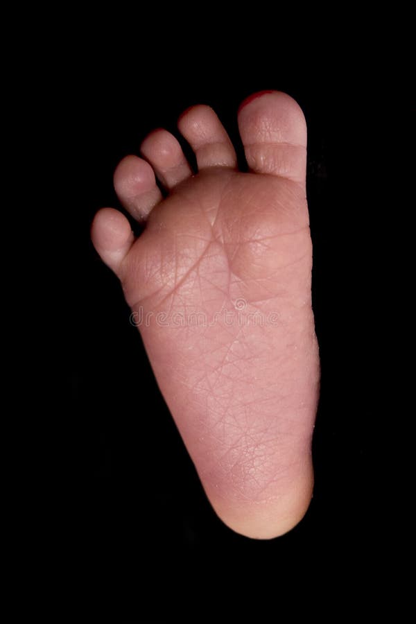 Baby foot