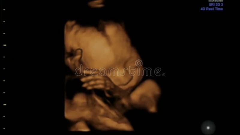 Baby Girl showing her fine Feminine Hands and Fingers. Footage of a Ultrasound 3d & 4d Gestation Scan