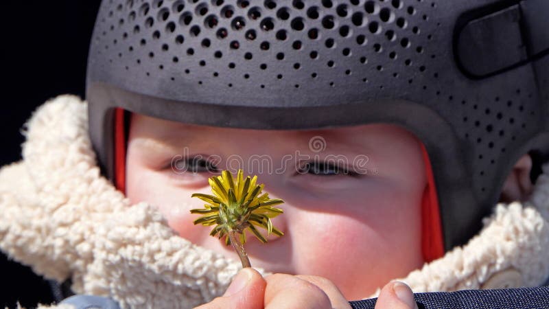 Baby girl wearing a cranial remoulding helmet flat head