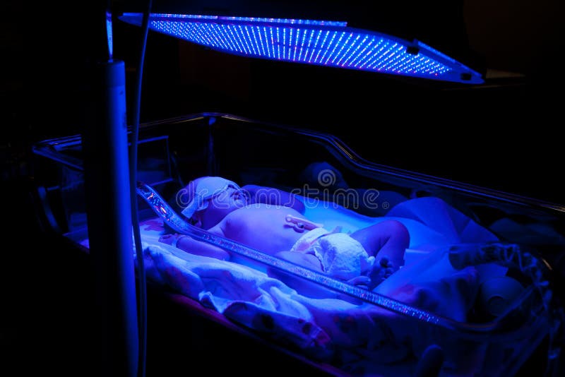 Baby with Phototherapy