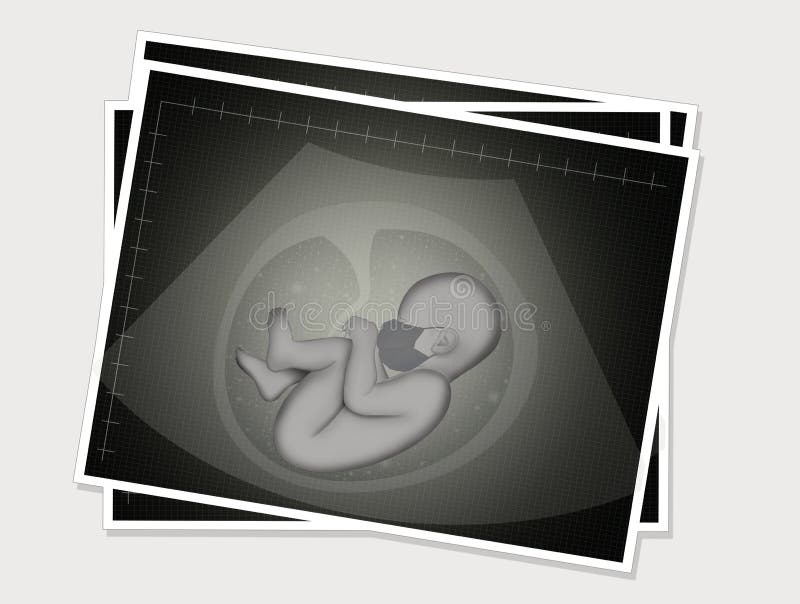 Download Baby Ultrasound Picture In Woman Hands Stock Vector ...