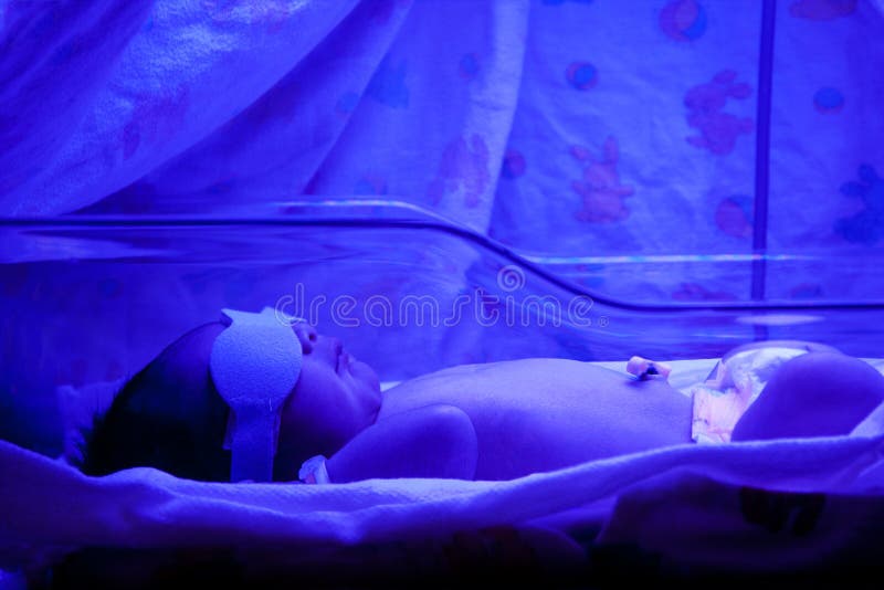 Baby under Phototherapy