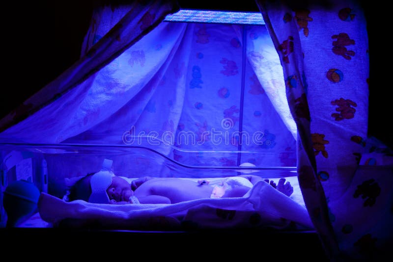 Baby under Phototherapy