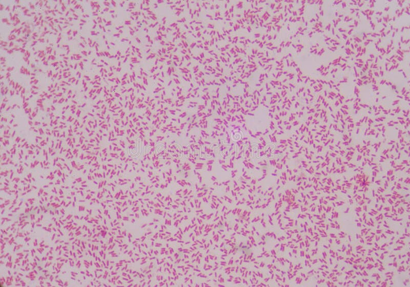 Bacilli gram-negativi immagine stock Bacilli gram-negativi immagine stock