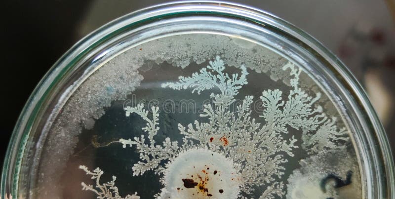 Bacillus subtilis colonies on saboraud dextrose agar medium