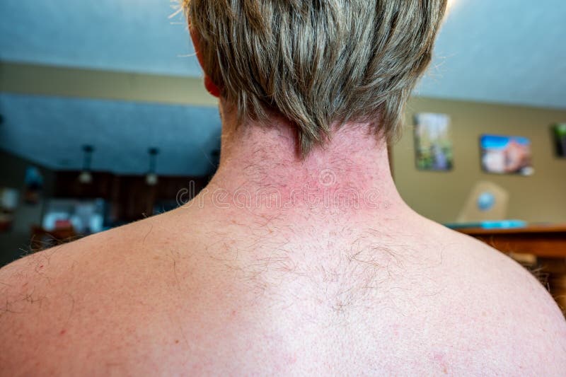 Middle Aged White Male with Patchy Back Hair Stock Image - Image of adult, human: 207069893 Middle Aged White Male with Patchy Back Hair Stock Image - Image of adult, human: 207069893