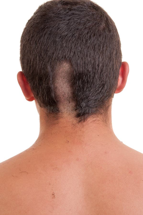 Back of Man Head while His Hair is Cut Stock Photo - Image of fashion, hairdresser: 38521732 Back of Man Head while His Hair is Cut Stock Photo - Image of fashion, hairdresser: 38521732