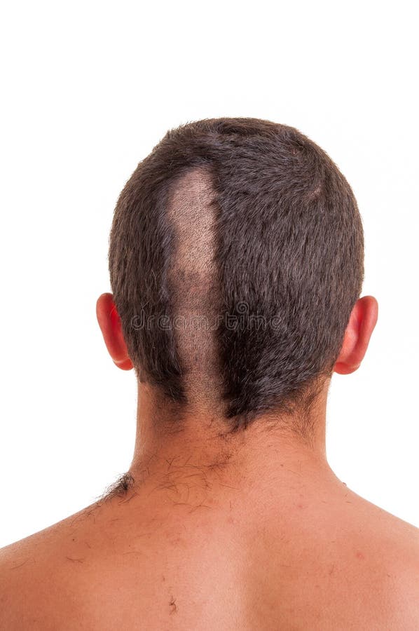 Back of Man Head while His Hair is Cut Isolated O Stock Photo - Image of  haircut, barber: 32332834