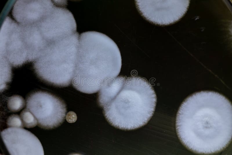 Different Shaped Colony of Bacteria and Mold Growing on Agar Plates