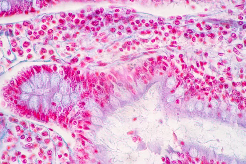 Tissue of Stomach Human, Small Intestine Human, Pancreas Human and ...