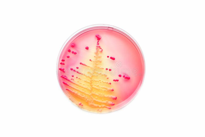 Bacteria colonies stock photo
