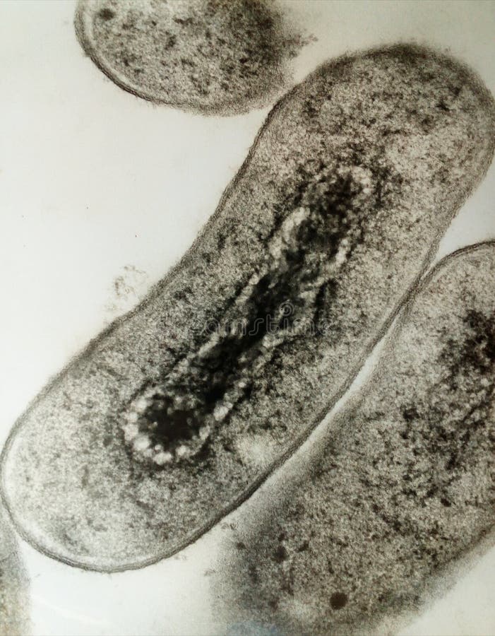 Cross section of Escherichia coli bacteria. Cross section of Escherichia coli bacteria