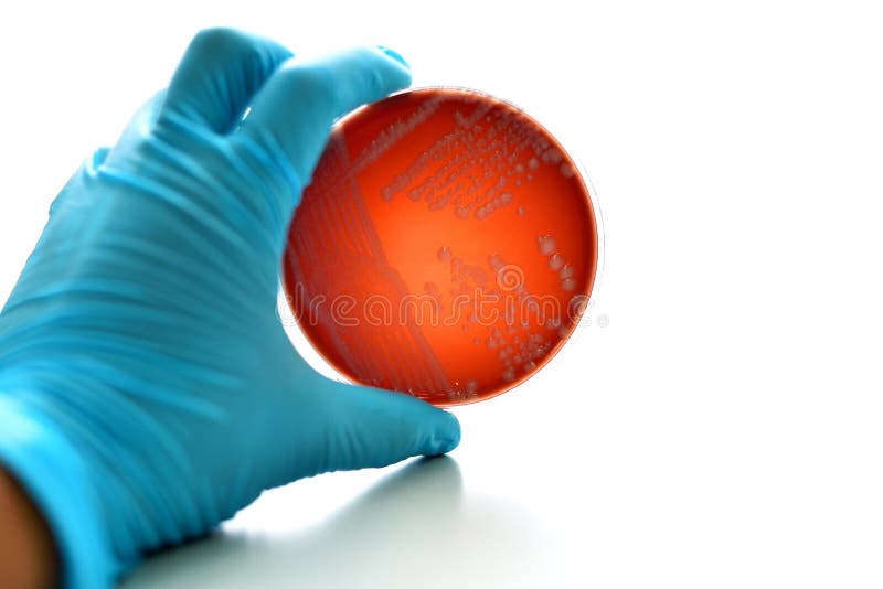 Bacteria culture royalty free stock photos