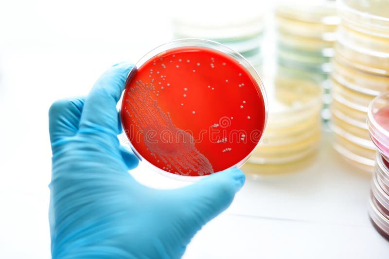 Bacteria culture stock photo. Image of dish, blood, aeruginosa 79117920