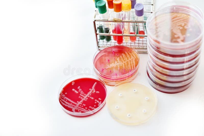Bacteria culture stock photo. Image of diphtheria, bacteria 93432086