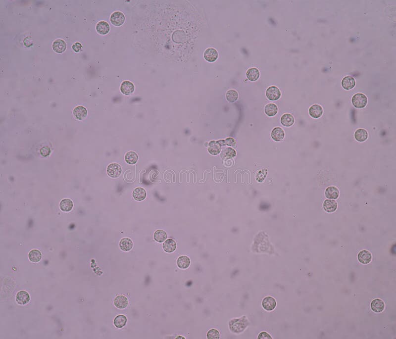 Bacteria in urine. stock photo. Image of abnormal, eosinophil 49923328