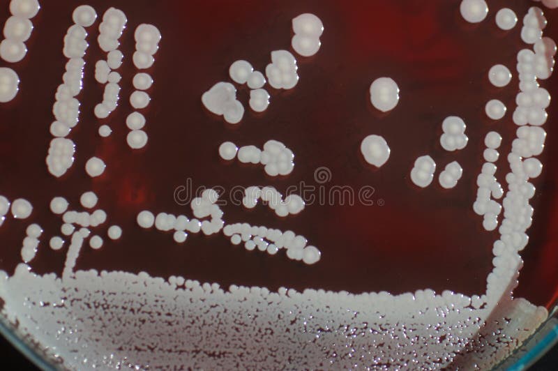 Red Bacterial Colonies On A Petri Dish Isolated On Black Stock Image Image of backgrounds