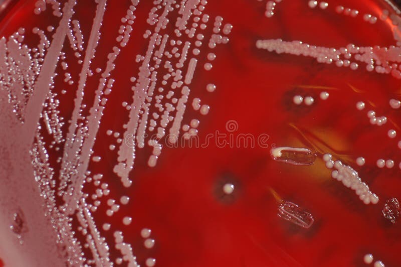 Bacterial Culture Growth On Blood Agar (Gram Negative Bacilli) Stock Photo Image of color