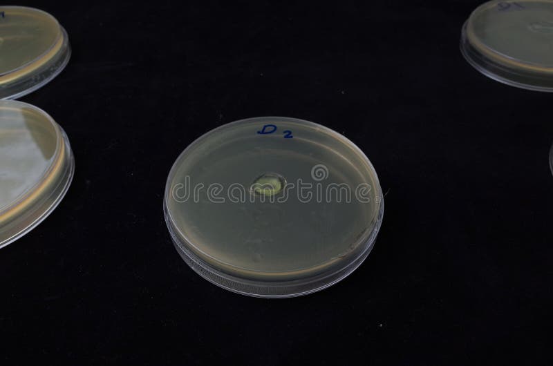 Bacterial Growth in Agar Plate Stock Photo - Image of bacterial, clean ...