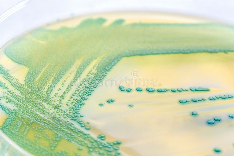 Bacterias en una placa de Petri